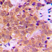 NF-kappaB p65 (Phospho-S468) Rabbit Polyclonal Antibody