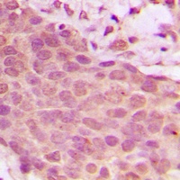 NF-kappaB p65 (Phospho-S536) Rabbit Polyclonal Antibody