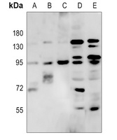 RFX3 Rabbit Polyclonal Antibody