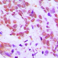 RFX3 Rabbit Polyclonal Antibody