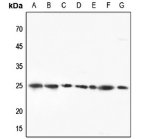 RPL10 Rabbit Polyclonal Antibody