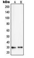 RPS8 Rabbit Polyclonal Antibody