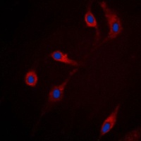 RRAD Rabbit Polyclonal Antibody