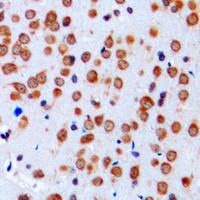Nav-pan Rabbit Polyclonal Antibody
