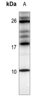 CXCL12 Rabbit Polyclonal Antibody