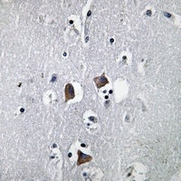 CXCL12 Rabbit Polyclonal Antibody