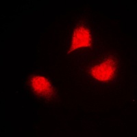 MKK4 (Phospho-T261) Rabbit Polyclonal Antibody