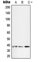 SFRP2 Rabbit Polyclonal Antibody