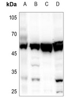 SKP2 Rabbit Polyclonal Antibody