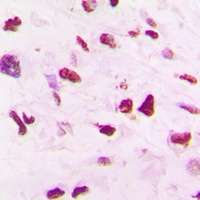 SKP2 Rabbit Polyclonal Antibody