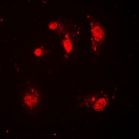 SKP2 Rabbit Polyclonal Antibody
