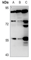 PEPT1 Rabbit Polyclonal Antibody