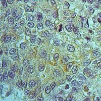 PEPT1 Rabbit Polyclonal Antibody