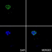 PEPT1 Rabbit Polyclonal Antibody