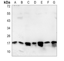 SUMO2/3 Rabbit Polyclonal Antibody