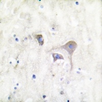 Beta-synuclein Rabbit Polyclonal Antibody