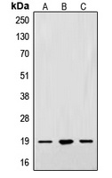 Alpha-synuclein Rabbit Polyclonal Antibody