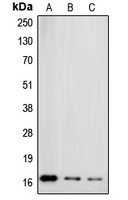 Gamma-synuclein Rabbit Polyclonal Antibody