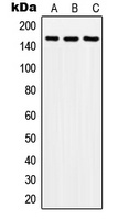 SOS2 Rabbit Polyclonal Antibody