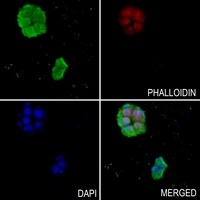 SOS2 Rabbit Polyclonal Antibody