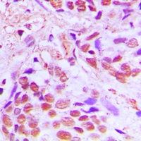 SRF Rabbit Polyclonal Antibody