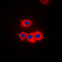 SSBP1 Rabbit Polyclonal Antibody