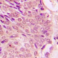 STAT1 (Phospho-S727) Rabbit Polyclonal Antibody