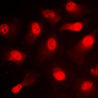 STAT1 (Phospho-S727) Rabbit Polyclonal Antibody