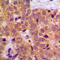 STAT1 Rabbit Polyclonal Antibody