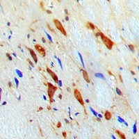 STAT1 Rabbit Polyclonal Antibody