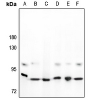 STAT3 Rabbit Polyclonal Antibody