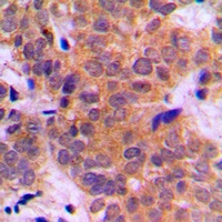 STAT3 Rabbit Polyclonal Antibody