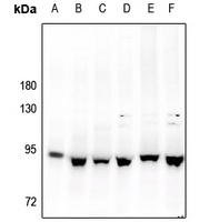 STAT3 Rabbit Polyclonal Antibody