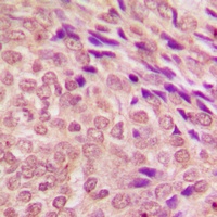 STAT3 Rabbit Polyclonal Antibody