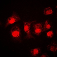 STAT3 Rabbit Polyclonal Antibody