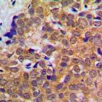 STAT5 Rabbit Polyclonal Antibody