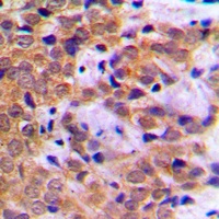 STAT5A (Phospho-S780) Rabbit Polyclonal Antibody