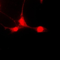 STAT5A (Phospho-S780) Rabbit Polyclonal Antibody
