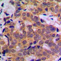 STAT5A Rabbit Polyclonal Antibody