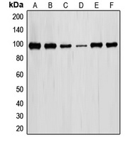 STAT6 Rabbit Polyclonal Antibody