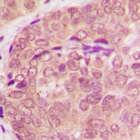 STAT6 Rabbit Polyclonal Antibody