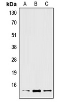XCL2 Rabbit Polyclonal Antibody