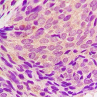 SYK (Phospho-Y323) Rabbit Polyclonal Antibody
