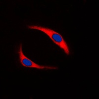 SYK (Phospho-Y323) Rabbit Polyclonal Antibody