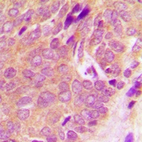 SYK Rabbit Polyclonal Antibody