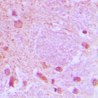 TCF3 Rabbit Polyclonal Antibody