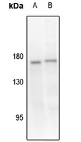 TIE2 (Phospho-Y1108) Rabbit Polyclonal Antibody