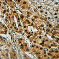 TIE2 (Phospho-Y1108) Rabbit Polyclonal Antibody
