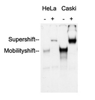 AP2 alpha/beta Rabbit Polyclonal Antibody