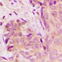TGF beta 1 Rabbit Polyclonal Antibody